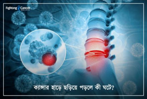 ক্যান্সার হাড়ে ছড়িয়ে পড়লে কী ঘটে?