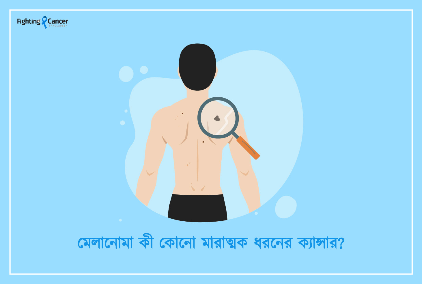 মেলানোমা কী কোনো মারাত্মক ধরনের ক্যান্সার?