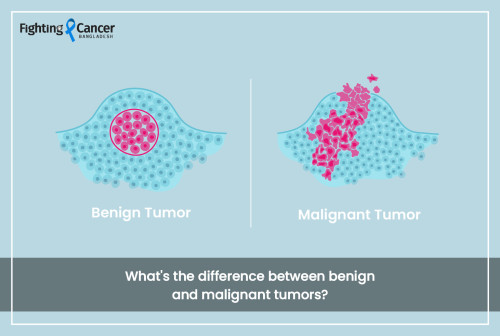 What's the difference between benign and malignant tumors?