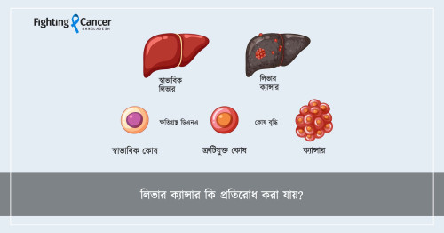 লিভার ক্যান্সার কি প্রতিরোধ করা যায়?